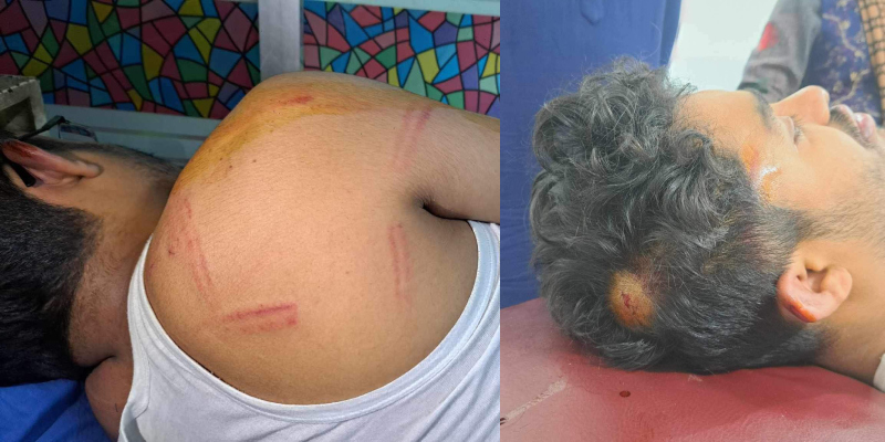 Titumir College Chhatra League assaults journalist with rod